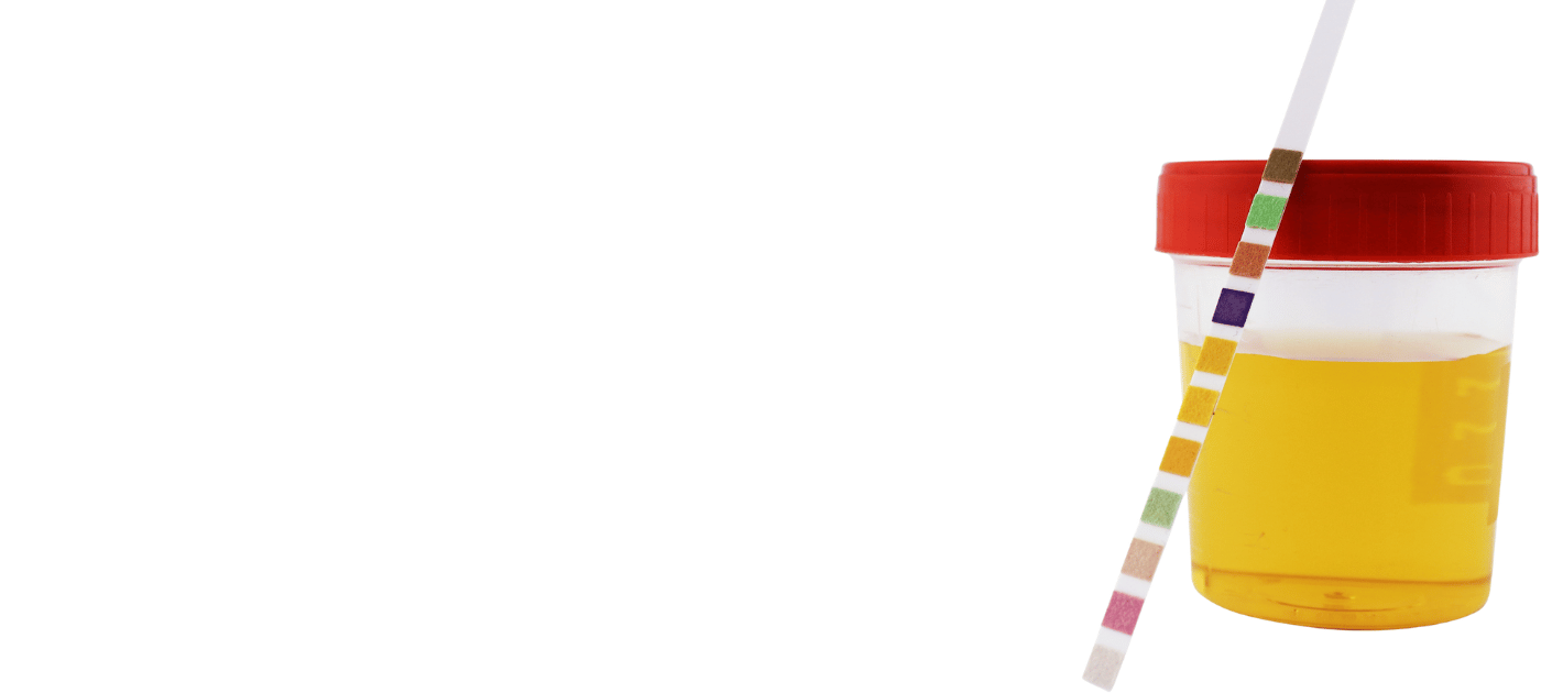 Routine and 24-Hour Urine Collection